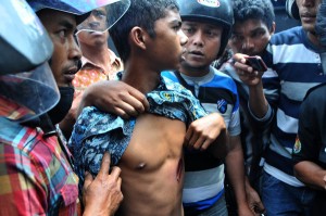 Salah seorang pengunjukrasa menunjukkan luka terkena ditubuhnya yang diduga terkena peluru karet. (LGco-d'aKa)