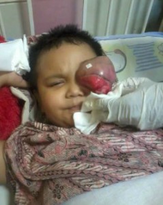 tmp_4988-Sdh 2 th mengidap tumor ganas,mohon bantuanny bagi yg ada rejeki lbh alamat di desa paya reje-1427331956