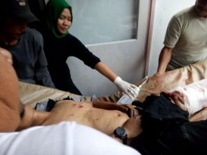 Korban ledakan mobil di Bener Meriah (Foto : Ist)