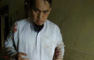 Kondisi Anggota Panwaslu Agara Ustadz Suryadinsyah Paska Aniaya